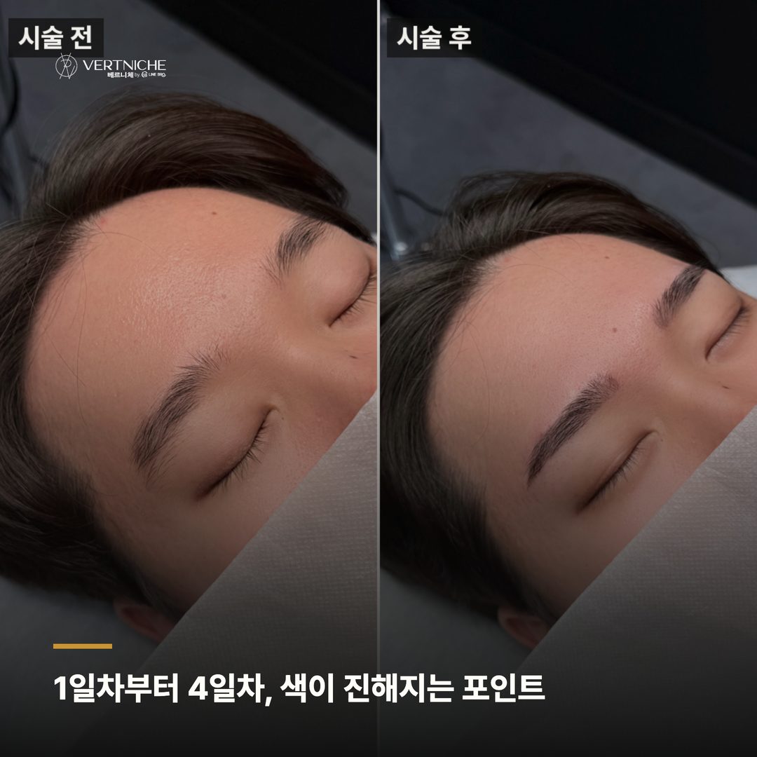 1일차부터 4일차, 색이 진해지는 게 정상입니다 - 핵심 포인트