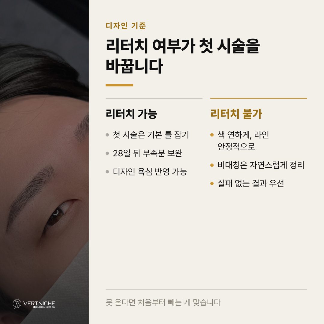 리터치 없는 조건일 때 첫 시술 디자인 원칙 비교