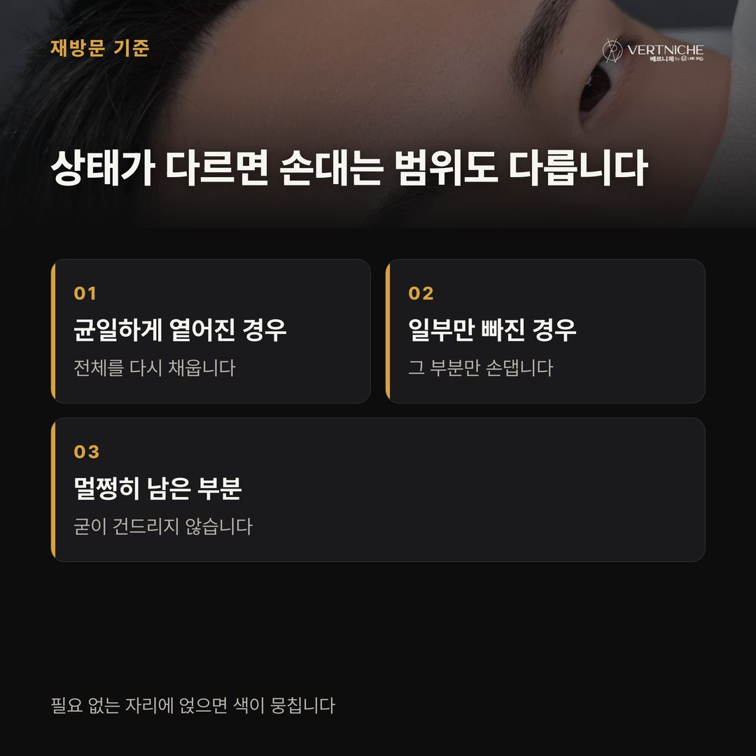 전체 재시술과 부분 보완 판단 기준 비교 정리