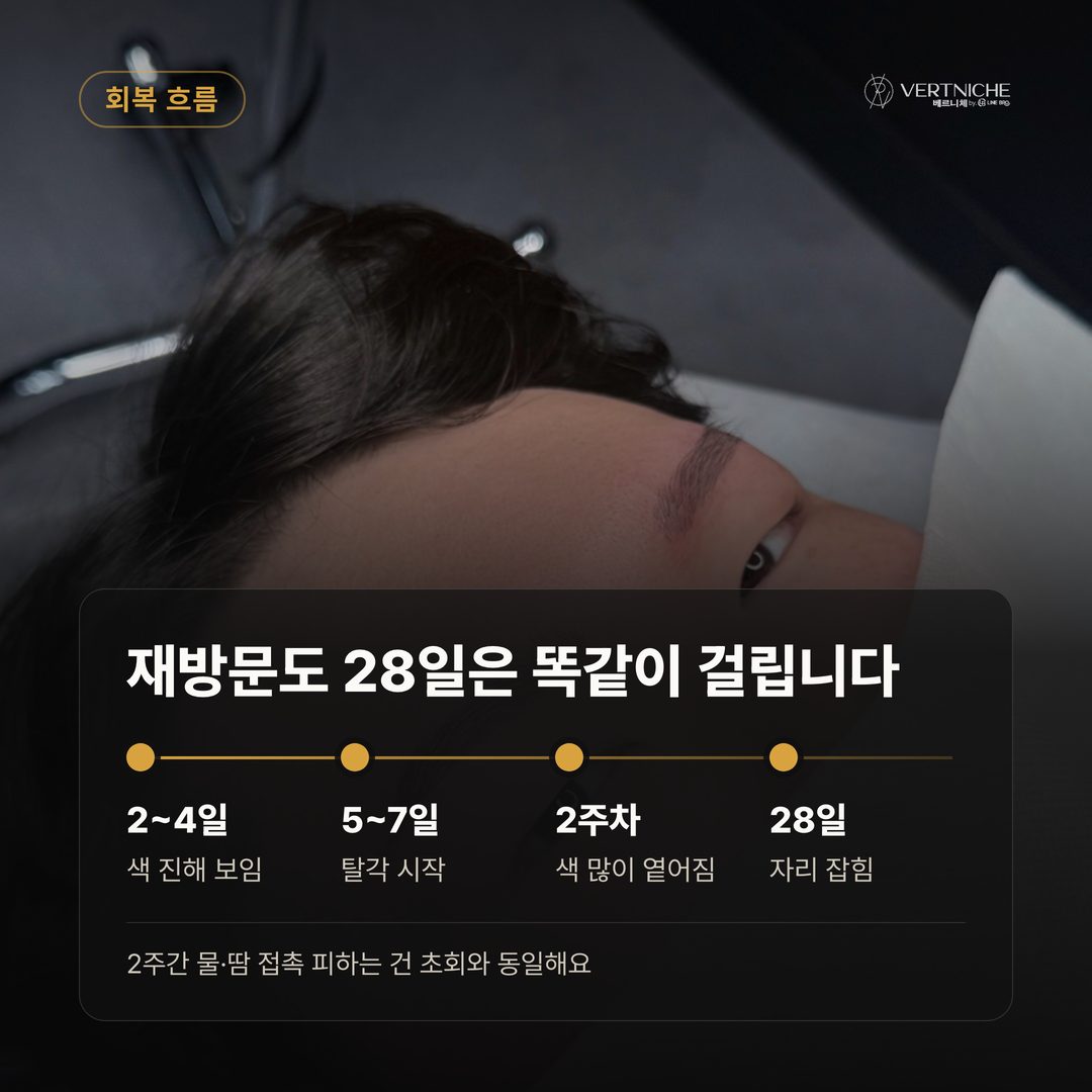재방문 비용 및 타샵 시술 후 재시술 자주 묻는 질문 답변