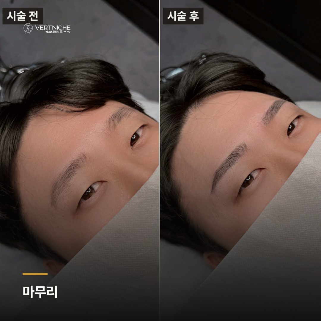 동성로 눈썹문신 재방문 상담 안내 마무리