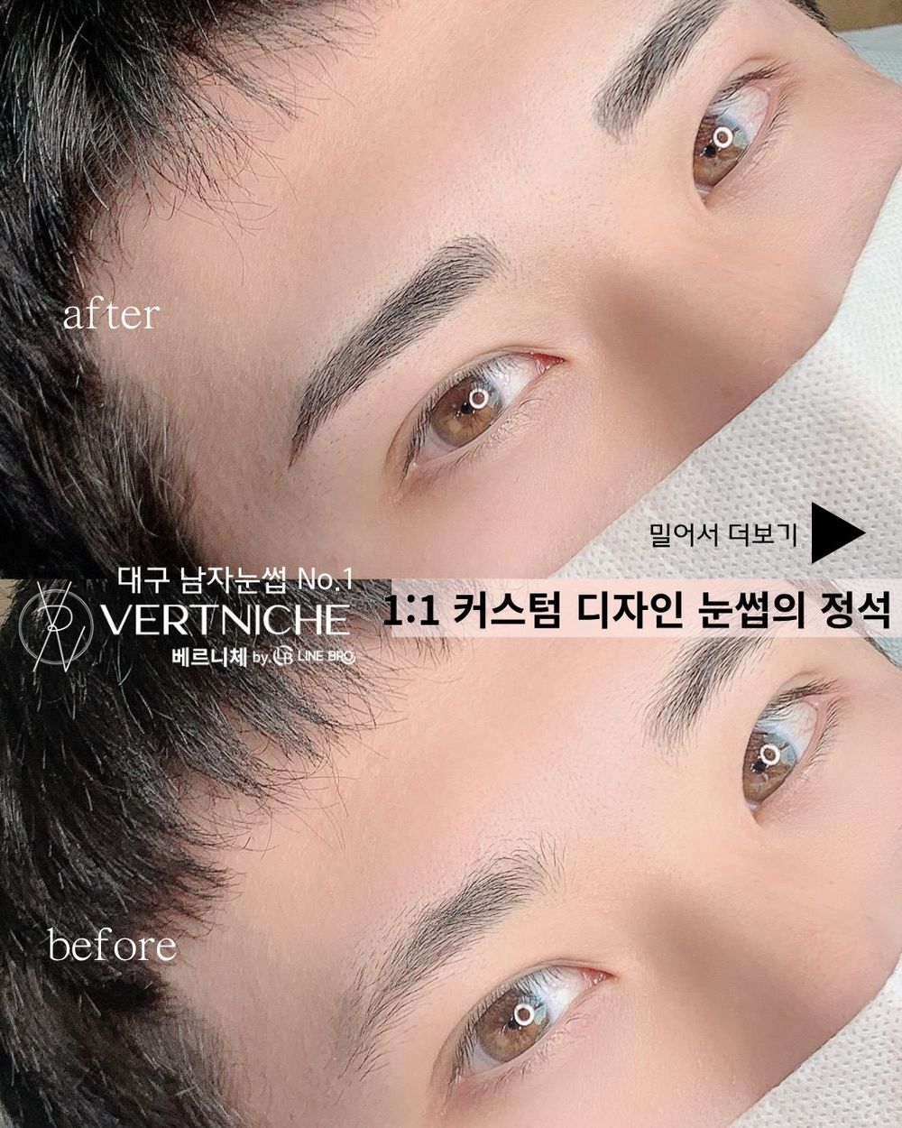 before → after, 차이 보이시나요?