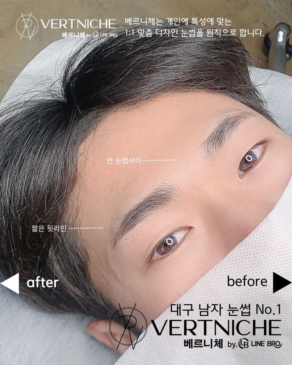눈썹사이 먼 간격, 짧은 뒷라인.