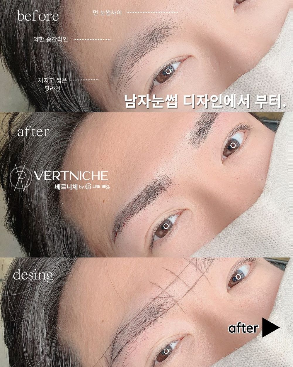 남자눈썹, 시술에서 말고 디자인에서 갈립니다.