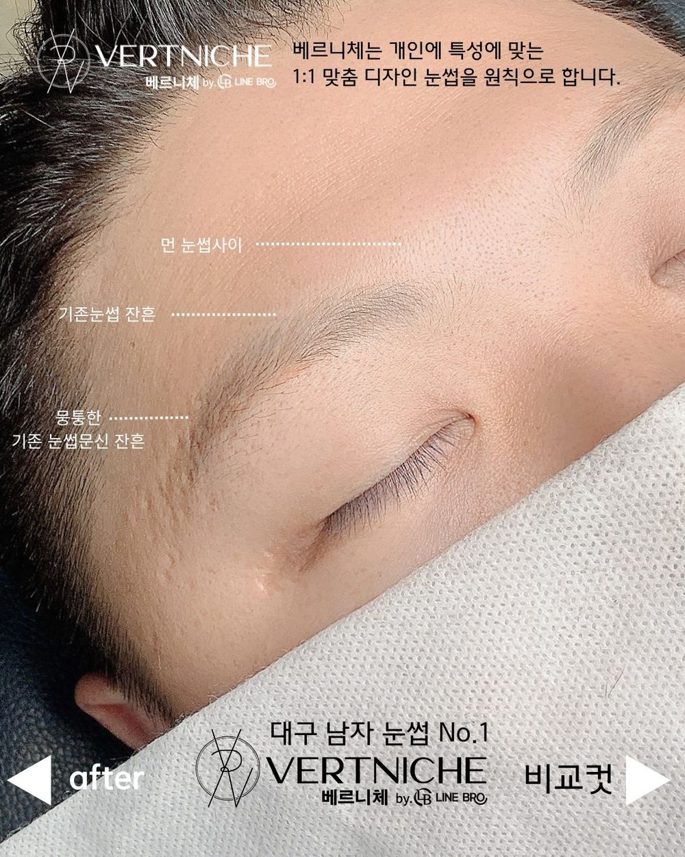 눈썹 사이 거리 하나로, 눈까지 달라 보입니다.